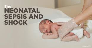 Image result for Neonatal Sepsis