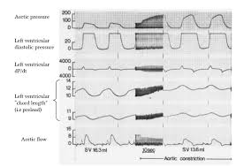 Image result for Preload