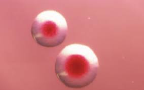 Image result for yersinia fotos