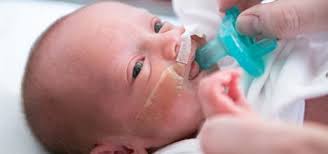 Image result for Preterm Infant