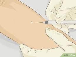 How To Get Tested For Allergies 15 Steps With Pictures
