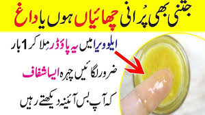 Lemon juiceworks as one of the best dark spot removers. How To Remove Freckles On Nose In 15 Days Freckle Remover Freckles Treatment Dark Spots On Face