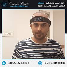 زراعة الشعر في تركيا و عمليات التجميل Baseball Cards Sports Baseball