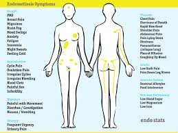1 when they do occur, symptoms, such as the following, typically reflect the area of involvement Endostats On Twitter Endometriosis Symptoms Can Vary Between Individuals Signs Can Be Seen By The Change In Your Body During Your Cycle Endometriosis Health Https T Co Mk0osbqsrw
