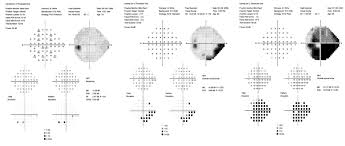 11 Rational Snellen Chart Explained