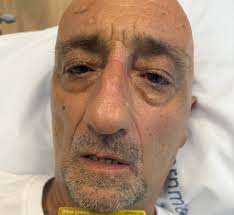 Husband's aorta ruptured, survived emergency surgery