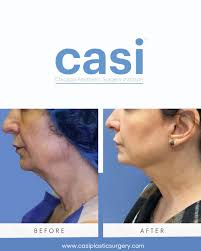 Chicago Aesthetic Surgery Institute