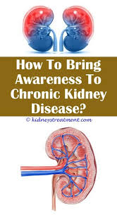 Marvelous Cool Tips 39567 Top Kidney Disease Doctor What Causes Kidney Disease Neonatal Kidney D Kidney Infection Kidney Failure Diet Kidney Disease Awareness