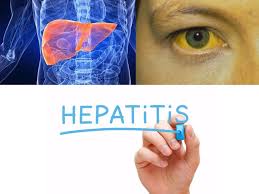 Deteksi Hepatitis Sejak Dini - K24Klik