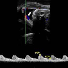 Pdf Application Of Ultrasonography In Canine Pregnancy An Overview