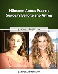 Madchen Amick Plastic Surgery Before And After Plastic Surgery Celebrity Surgery Surgery