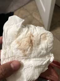 How to tell the implantation bleeding is a small amount of spotting or bleeding that happens after a newly fertilized. Tmi Implantation Bleeding Graphic Picture Trying For A Baby Babycenter Canada