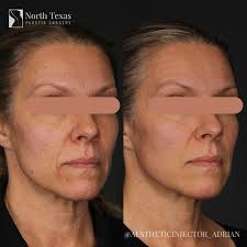 𝐀𝐝𝐫𝐢𝐚𝐧