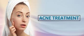Acne Treatment in Faridabad