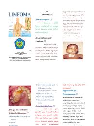 Laparoscopic splenectomy for non hodgkins lymphomahow lymphoma develops 2021, mungkin. 292833812 Leaflet Limfoma Maligna