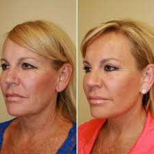Premier Plastic Surgery