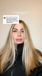 also SEVERE ITCHING. to the point to where my legs were covered in bruises  and it was to constant need to scratch was affecting me mentally. ,  #hodgkinslymphoma #stage4cancer #hodgkins #cancerssucks ...