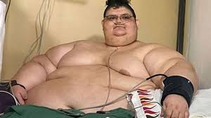 Diaporama «la plus grosse femme du monde» soignée en inde. L Homme Le Plus Gros Du Monde A Perdu Son Record En Perdant Pres De 300 Kilos