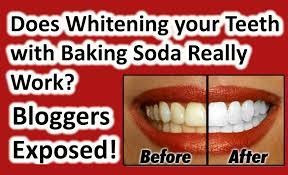 Smoking is another major cause of stained teeth. Does Whitening Your Teeth With Baking Soda Really Work Dentist Rancho Cucamonga