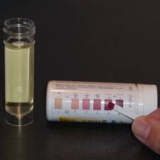 It's usually tried in children between the ages of one and twelve years who have seizures that are hard to control, or have certain kinds of syndromes, such as glucose tranporter or pyruvate dehydrogenase deciencies. Ketogenic Diet Wikipedia