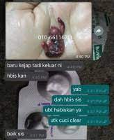 Maybe you would like to learn more about one of these? Klinik Pembekal Ubat Gugur Kandungan Malaysia 0168683038 Mtp Kit Ubat Gugur Pil Gugur Cytotec Cytolog Malaysialistings