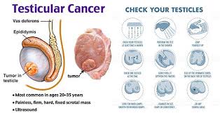 The most common type of testicular cancer is germ cell testicular cancer, which accounts for around 95% of all cases. The Namibian Pa Twitter Although Testicular Cancer Is Rare Men Are Advised To Make It A Point To Self Examine Their Testicles On A Monthly Basis As A Means Of Detecting Early Signs