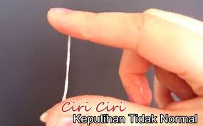 Check spelling or type a new query. Solusi Keputihan Abnormal Cara Mengatasi Keputihan Berwarna Coklat Secara Alami