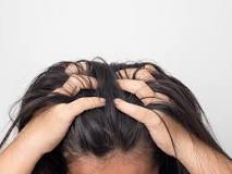Image result for why is my scalp itchy after keratin treatment