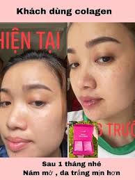 Profile for Collagen Bena Thanh Xuân Cho Làn Da