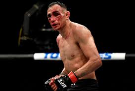 Dominick cruz is back, amanda nunes and megan anderson face off. Tony Ferguson Suffered Horror Broken Eye Socket In Brutal Ufc 249 Loss To Justin Gaethje