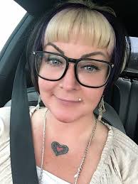 CO2 Fractional Laser... Deka Dot. Lee's Summit, MO