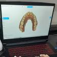 Intraoral 3D Digital Scanner product image