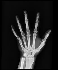 Wondering How Much To Spend On Health Insurance Follow My Healthcare Affordability Ratio Bones Bone Density Bone Density Test