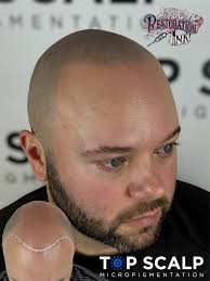 Just 1 session of Beard Micropigmentation✍🏼 😎 Amazing results in 1  visit💯 Experience the difference at Restoration Ink☝🏼 North Carolina's  Most Natural looking SMP 🥇💪🏼 Top Results Guaranteed🏆🧨 Consultations  are FREE📍Locations in