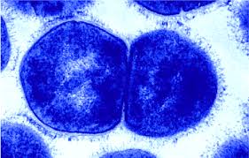 Image result for Group D Streptococcus