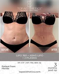 Here, we’ll clue you in about some of the best beaches, restaurants, and sites. Humberto Palladino Md Facs Palladinops Twitter