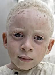 160 melhores ideias de Diversidade Humana