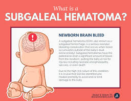 Pin On Baby Health Wellness