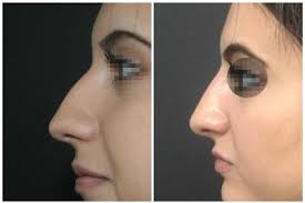 Dora Levy Abdulghani