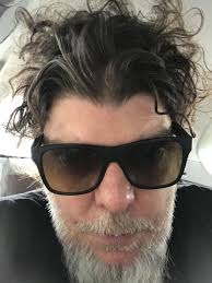 Com tumor na laringe, Branco Mello ficará afastado dos Titãs por 3 meses  para tratamento