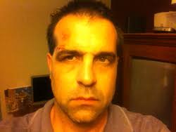 Mongielo Beaten, Arrested by Police in Lockport at Seat Belt Checkpoint