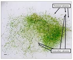 Image result for Microcoelia physophora