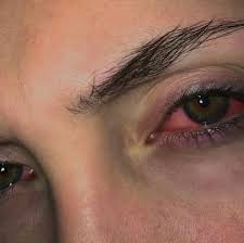 Patients with urgent eye conditions that require immediate attention should proceed to the mount. Urgent Care Eye Doctor Nyc Homes Of Heaven