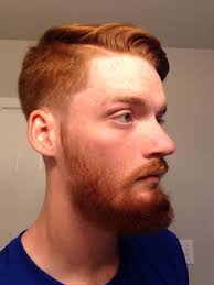 I am sorry to hear about your burn from waxing. 4 Months Still No Cheek Fill Beards