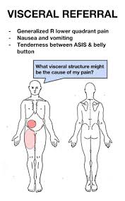 Visceral Pain Referral Snapspt