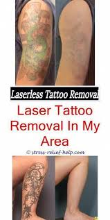 It is one of the best. Tattoo Eraser Will Tattoo Removal Scar Low Cost Tattoo Removal Permanent Tatto Tattoos Tattooentfernung Tatowierungen Haut Tattoo