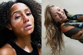 Vijf twintigers vertellen het verhaal achter hun (im)perfectie: “Mijn  moeder hield er veel schuldgevoel aan over”