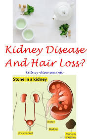 Pin On Kidney Infection Medicine