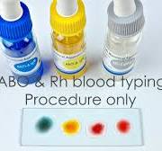Abo Blood Grouping Test Procedure
