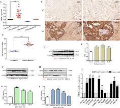 This cancer is also called gastric cancer. Potent And Specific Mth1 Inhibitors Targeting Gastric Cancer Cell Death Disease